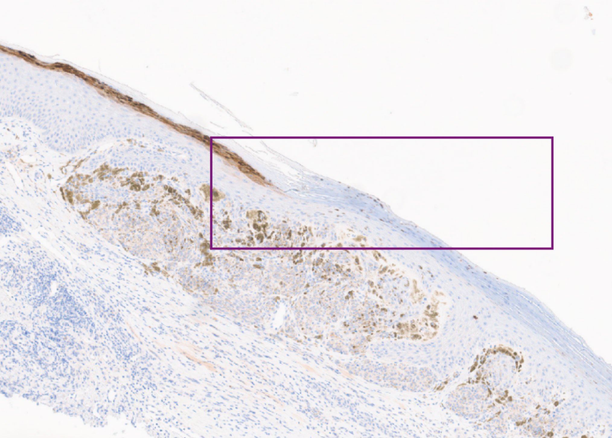 Histopathology slide – loricin lost (4x magnification)